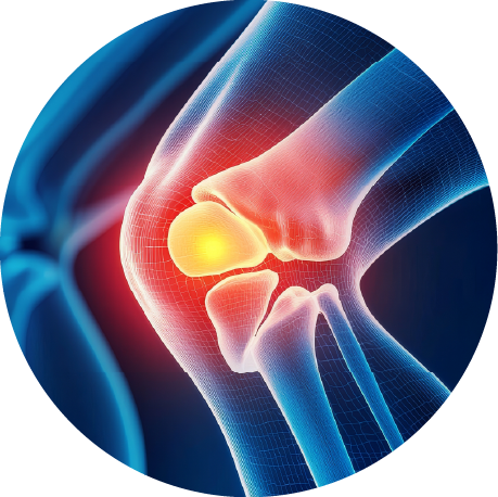 Reduces swelling<br> in joints